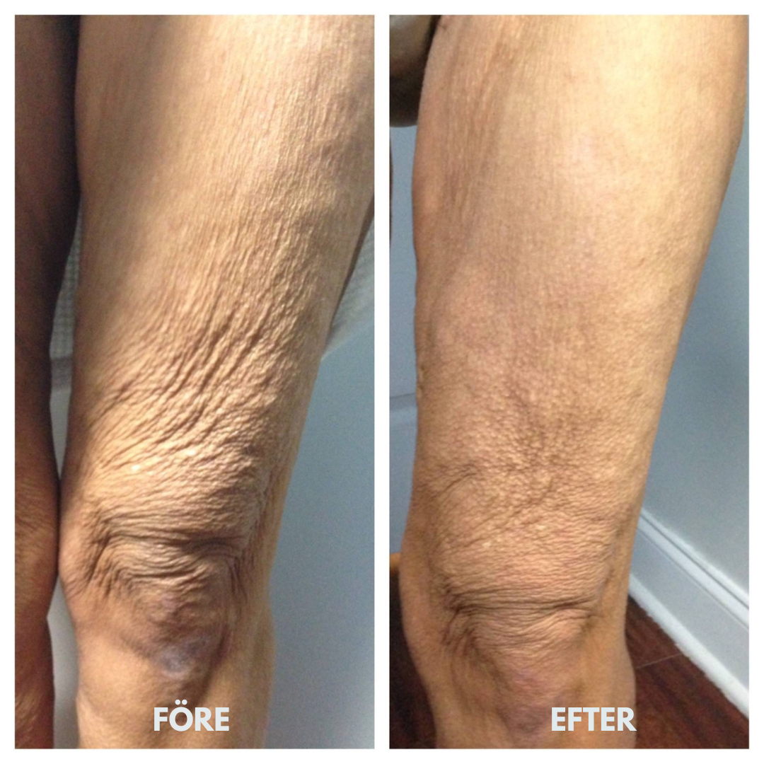 Luméva – Rejuvenating Body Oil