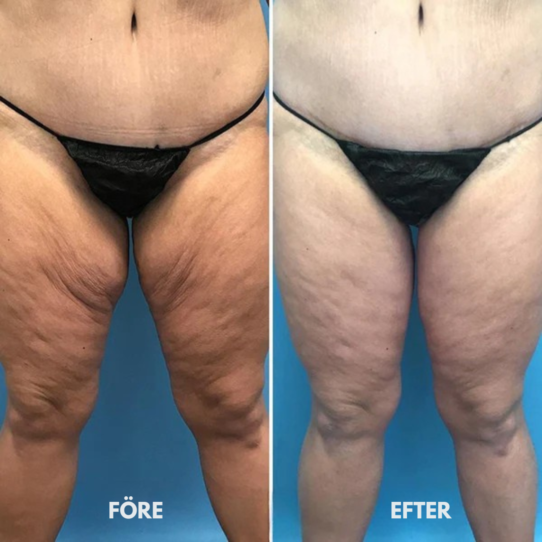 Luméva – Rejuvenating Body Oil